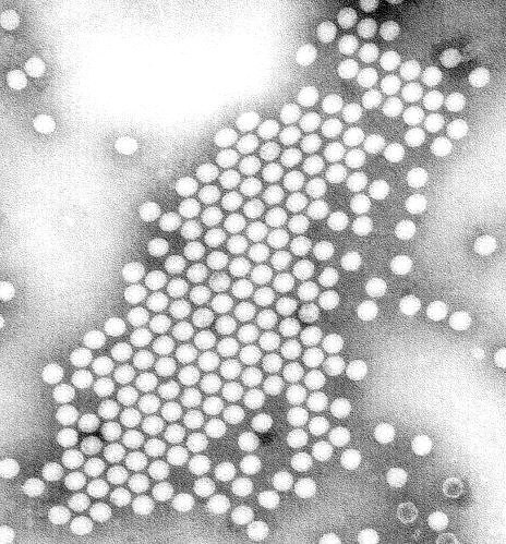 Electron microscopy of poliovirus