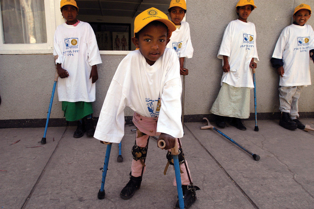 Image of child with paralysis from polio