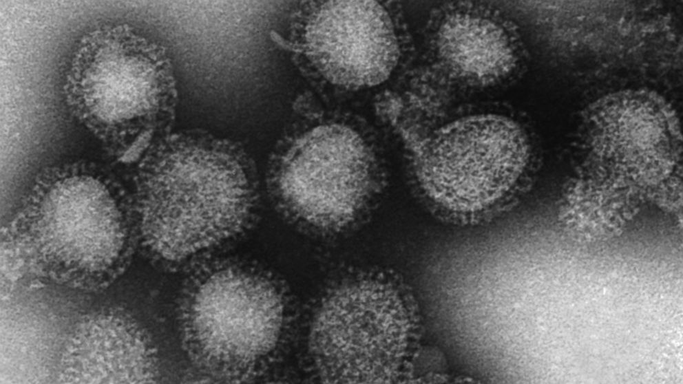 Electron microscopy of influenza virus