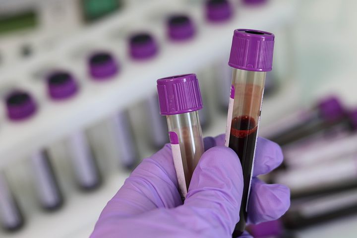 lab tests can detect exposure to or immunity to hepatitis b